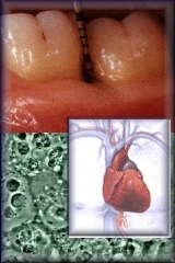 cuore_denti.jpg (26702 byte)