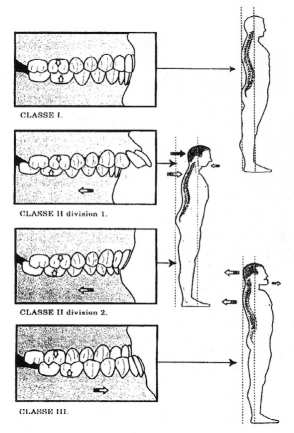 occlusione.jpg (178655 byte)