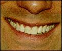 smileaft.jpg (3738 byte)