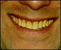 smilebef.jpg (3794 byte)